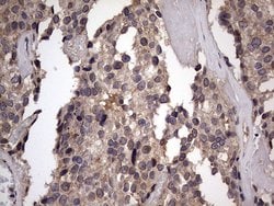 Invitrogen ZNF286A Monoclonal Antibody (OTI7D2) 100 &mu;L; Unconjugated:Antibodies,