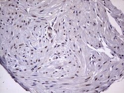 Invitrogen ZNF286A Monoclonal Antibody (OTI7D2) 100 &mu;L; Unconjugated:Antibodies,