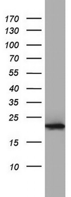 Invitrogen PPIH Monoclonal Antibody (OTI2D11) 100 &mu;L; Unconjugated:Antibodies,