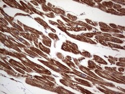 Invitrogen TACC2 Monoclonal Antibody (OTI3C4) 100 &mu;L; Unconjugated:Antibodies,