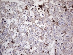 Invitrogen TACC2 Monoclonal Antibody (OTI3C4) 100 &mu;L; Unconjugated:Antibodies,