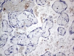 Invitrogen TACC2 Monoclonal Antibody (OTI3C4) 100 &mu;L; Unconjugated:Antibodies,