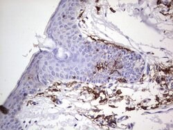 Invitrogen TACC2 Monoclonal Antibody (OTI1C3) 100 &mu;L; Unconjugated:Antibodies,