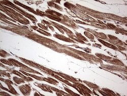 Invitrogen TACC2 Monoclonal Antibody (OTI1C3) 100 &mu;L; Unconjugated:Antibodies,