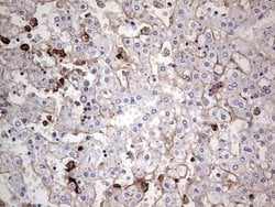 Invitrogen TACC2 Monoclonal Antibody (OTI1C3) 100 &mu;L; Unconjugated:Antibodies,