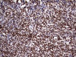 Invitrogen CK1 epsilon Monoclonal Antibody (OTI5D4) 100 &mu;L; Unconjugated:Antibodies,