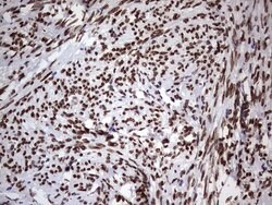 Invitrogen CK1 epsilon Monoclonal Antibody (OTI5D4) 100 &mu;L; Unconjugated:Antibodies,