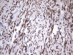 Invitrogen CK1 epsilon Monoclonal Antibody (OTI5D4) 100 &mu;L; Unconjugated:Antibodies,