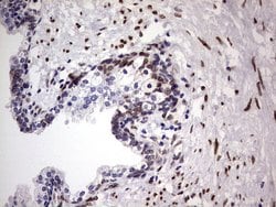 Invitrogen CK1 epsilon Monoclonal Antibody (OTI5D4) 100 &mu;L; Unconjugated:Antibodies,