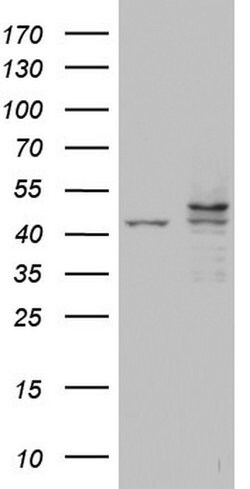 Invitrogen CK1 epsilon Monoclonal Antibody (OTI5C9) 100 &mu;L; Unconjugated:Antibodies,