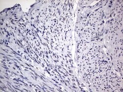 Invitrogen RTRAF Monoclonal Antibody (OTI2A4) 100 &mu;L; Unconjugated:Antibodies,