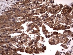 Invitrogen NRBF2 Monoclonal Antibody (OTI1B2) 100 &mu;L | Buy Online | Invitrogen&trade; | Fisher Scientific