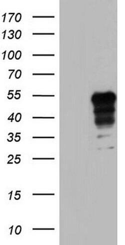 Invitrogen NRBF2 Monoclonal Antibody (OTI1B2) 100 &mu;L | Buy Online | Invitrogen&trade; | Fisher Scientific