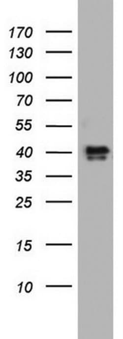 Invitrogen NRBF2 Monoclonal Antibody (OTI1A2) 100 &mu;L | Buy Online | Invitrogen&trade; | Fisher Scientific