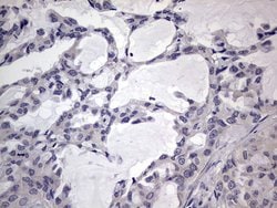 Invitrogen MURF3 Monoclonal Antibody (OTI7F8) 100 &mu;L; Unconjugated:Antibodies,