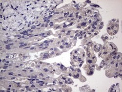 Invitrogen MURF3 Monoclonal Antibody (OTI7F8) 100 &mu;L; Unconjugated:Antibodies,