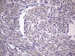 Invitrogen MURF3 Monoclonal Antibody (OTI7F8) 100 &mu;L; Unconjugated:Antibodies,