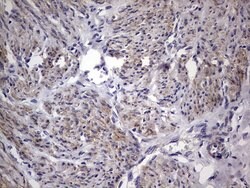 Invitrogen MURF3 Monoclonal Antibody (OTI7F8) 100 &mu;L; Unconjugated:Antibodies,
