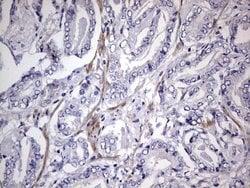 Invitrogen MURF3 Monoclonal Antibody (OTI7F8) 100 &mu;L; Unconjugated:Antibodies,