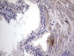 Invitrogen MURF3 Monoclonal Antibody (OTI7F8) 100 &mu;L; Unconjugated:Antibodies,