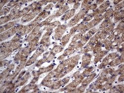 Invitrogen MURF3 Monoclonal Antibody (OTI5A11) 100 &mu;L; Unconjugated:Antibodies,