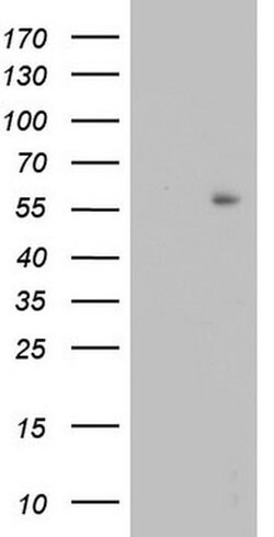 Invitrogen TRIM27 Monoclonal Antibody (OTI4D4) 100 &mu;L; Unconjugated:Antibodies,