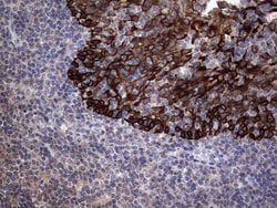Invitrogen MIP-3 beta Monoclonal Antibody (OTI2A12) 100 &mu;L; Unconjugated:Antibodies,