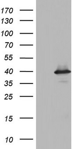 Invitrogen UFD1L Monoclonal Antibody (OTI8G6) 100 &mu;L | Buy Online | Invitrogen&trade; | Fisher Scientific