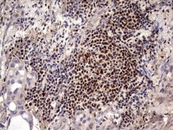 Invitrogen IKZF3 Monoclonal Antibody (OTI7E11) 100 &mu;L; Unconjugated:Antibodies,