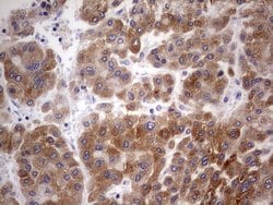 Invitrogen BFSP2 Monoclonal Antibody (OTI1D9) 100 &mu;L; Unconjugated:Antibodies,