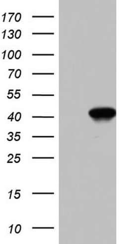 Invitrogen BFSP2 Monoclonal Antibody (OTI1D9) 100 &mu;L; Unconjugated:Antibodies,