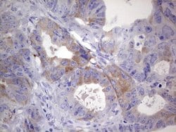 Invitrogen RRM1 Monoclonal Antibody (OTI16A8) 100 &mu;L | Buy Online | Invitrogen&trade; | Fisher Scientific