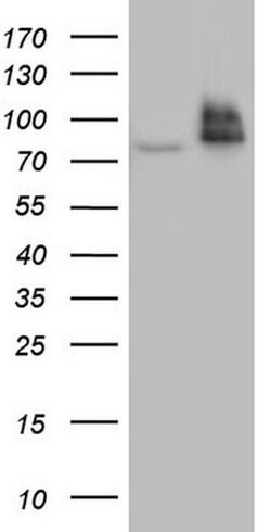Invitrogen RRM1 Monoclonal Antibody (OTI16A8) 100 &mu;L | Buy Online | Invitrogen&trade; | Fisher Scientific