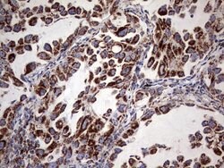 Invitrogen ATP Synthase O Monoclonal Antibody (OTI2E9) 100 &mu;L; Unconjugated:Antibodies,