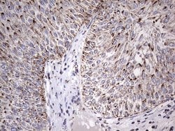 Invitrogen ATP Synthase O Monoclonal Antibody (OTI2E9) 100 &mu;L; Unconjugated:Antibodies,