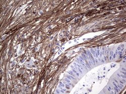 Invitrogen Periostin Monoclonal Antibody (OTI2B2) 100 &mu;L; Unconjugated:Antibodies,