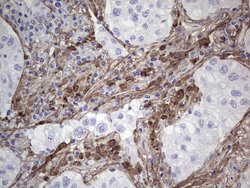 Invitrogen Periostin Monoclonal Antibody (OTI2B2) 100 &mu;L; Unconjugated:Antibodies,