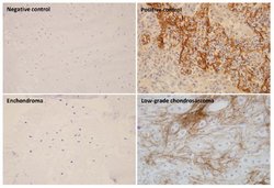 Invitrogen Periostin Monoclonal Antibody (OTI2B2) 100 &mu;L; Unconjugated:Antibodies,