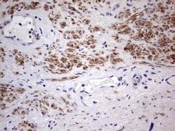 Invitrogen FLIP Monoclonal Antibody (OTI2H8) 100 &mu;L; Unconjugated:Antibodies,