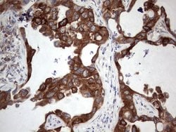 Invitrogen POMK Monoclonal Antibody (OTI1B1) 100 &mu;L; Unconjugated:Antibodies,