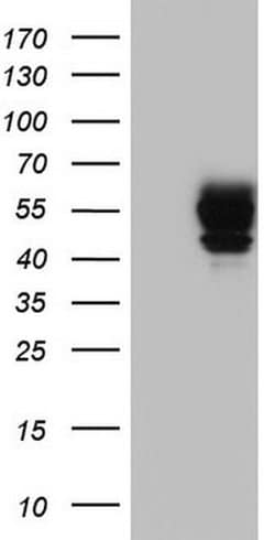 Invitrogen POMK Monoclonal Antibody (OTI1B1) 100 &mu;L; Unconjugated:Antibodies,