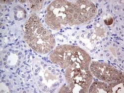 MAD2L1BP Monoclonal Antibody (OTI3C11):Antibodies, Monoclonal