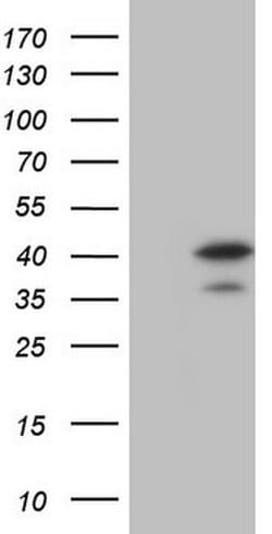 MAD2L1BP Monoclonal Antibody (OTI3C11):Antibodies, Monoclonal