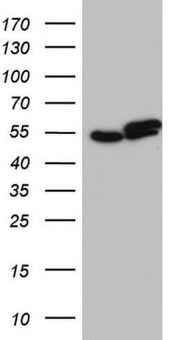 Invitrogen RAD23B Monoclonal Antibody (OTI9F8) 100 &mu;L; Unconjugated:Antibodies,