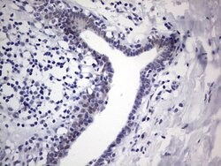 Invitrogen RAD23B Monoclonal Antibody (OTI7G10) 100 &mu;L; Unconjugated:Antibodies,