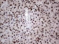 Invitrogen RAD23B Monoclonal Antibody (OTI7G10) 100 &mu;L; Unconjugated:Antibodies,