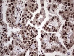 Invitrogen RAD23B Monoclonal Antibody (OTI7G10) 100 &mu;L; Unconjugated:Antibodies,