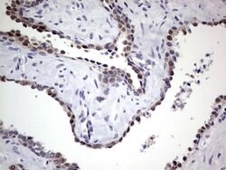 Invitrogen RAD23B Monoclonal Antibody (OTI7G10) 100 &mu;L; Unconjugated:Antibodies,