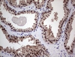 Invitrogen RAD23B Monoclonal Antibody (OTI7G10) 100 &mu;L; Unconjugated:Antibodies,