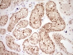 Invitrogen NOR-1 Monoclonal Antibody (OTI5C2) 100 &mu;L; Unconjugated:Antibodies,